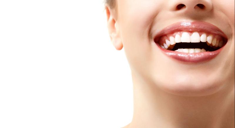 Trường hợp được tẩy trắng răng