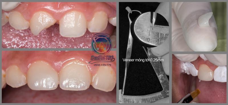 TSG Dental