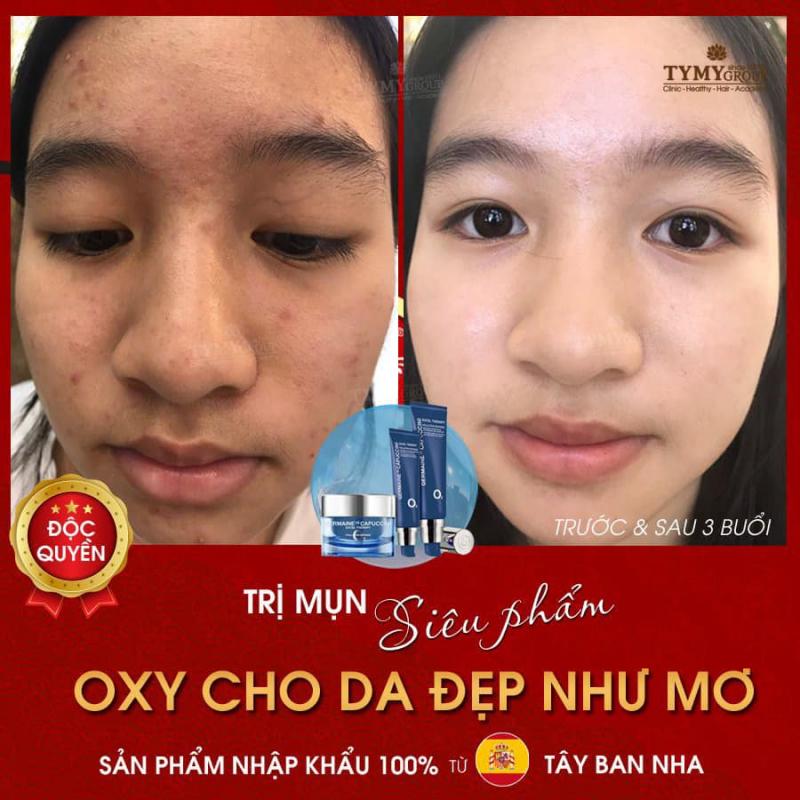 TyMy Spa