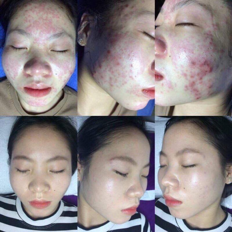 Viện Thẩm Mỹ Ula