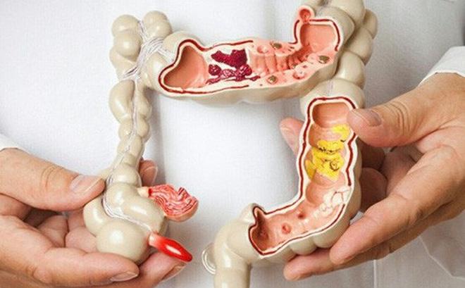 Thời gian dài ủ bệnh thì thông thường người bệnh sẽ không có triệu chứng cụ thể gì
