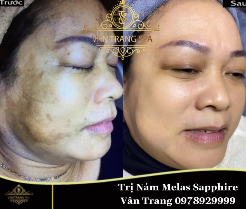 Vân Trang Spa