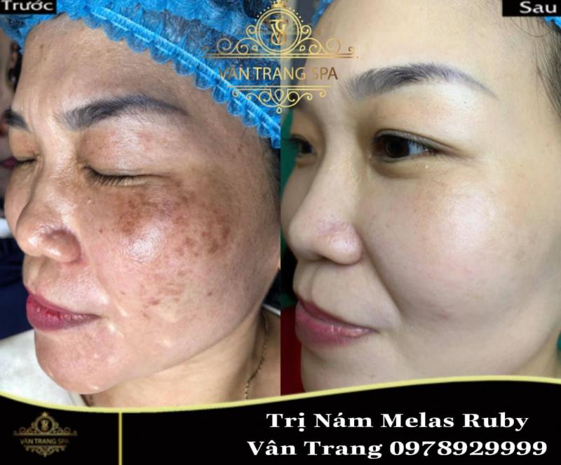 Vân Trang Spa
