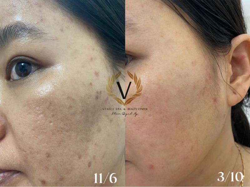 Venice Spa & Beauty Center Phan Rang