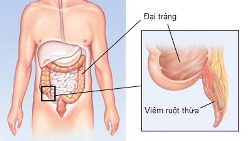 Ảnh minh họa (Nguồn Internet)