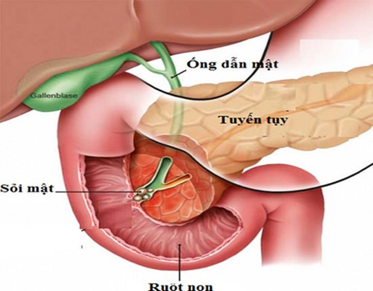 Ảnh minh họa (Nguồn Internet)