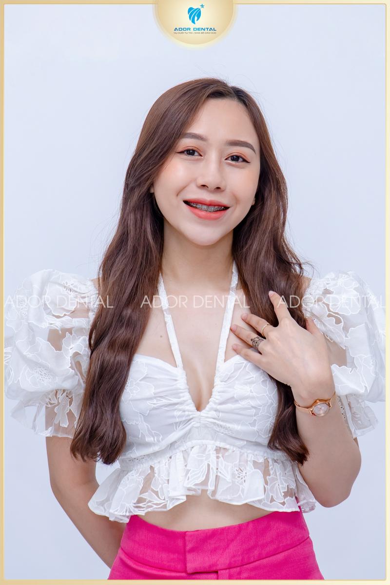 Viện Nha Khoa Thẩm Mỹ Ador Dental