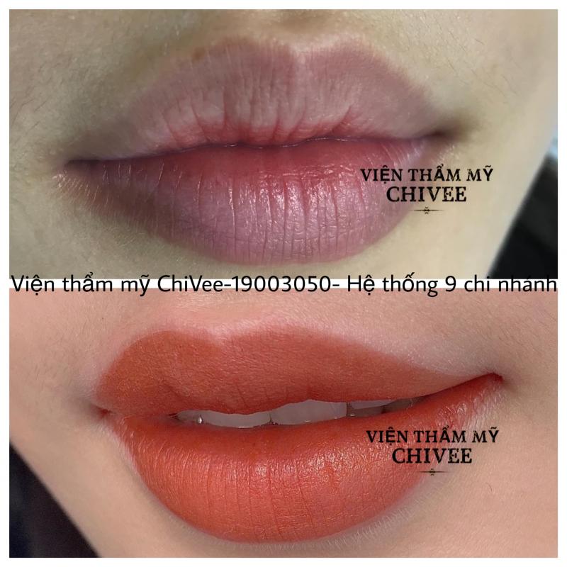 Viện Thẩm Mỹ ChiVee