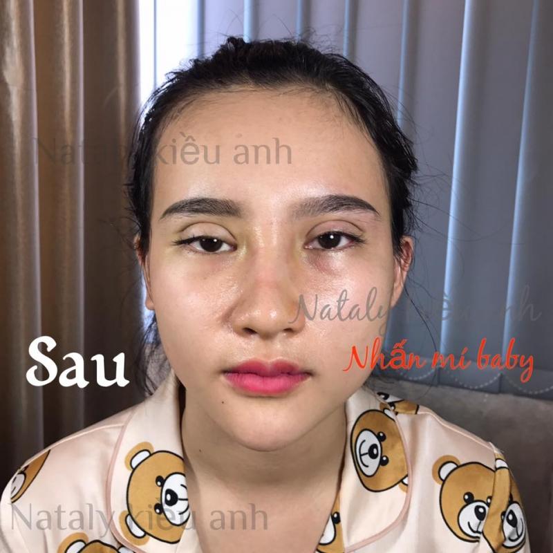 Viện Thẩm Mỹ Công Nghệ Cao Nataly