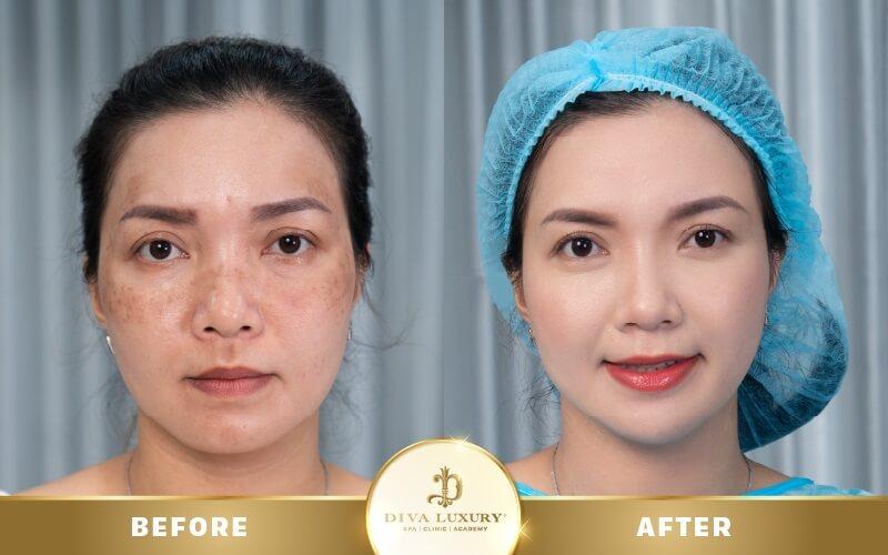 Viện thẩm mỹ Diva