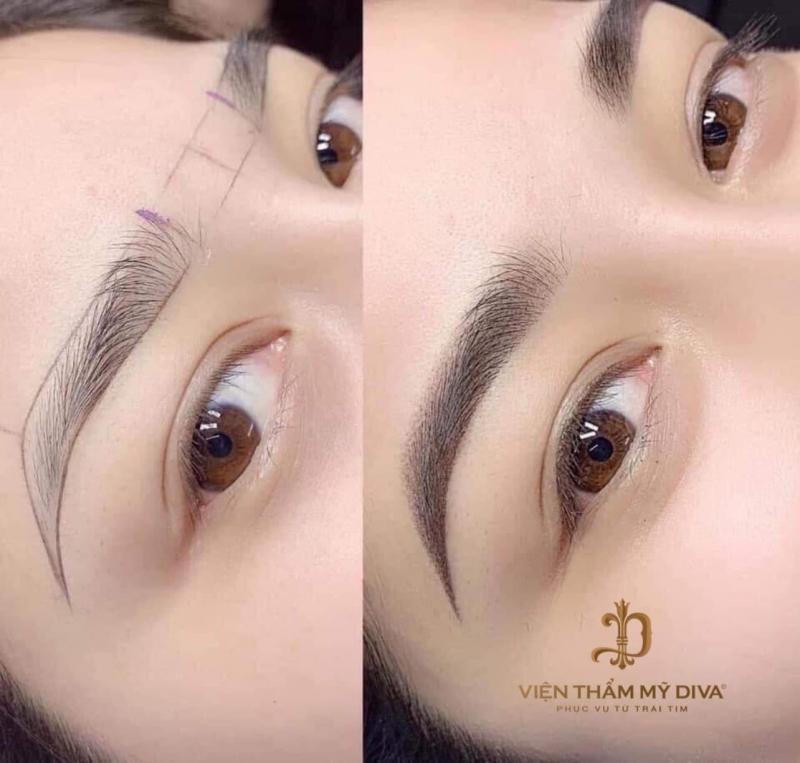 Viện Thẩm Mỹ DIVA