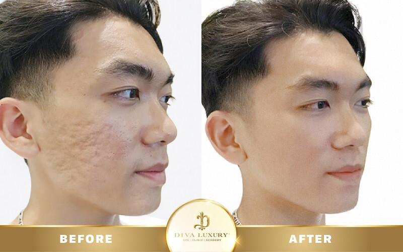 DIVA Spa Quảng Nam