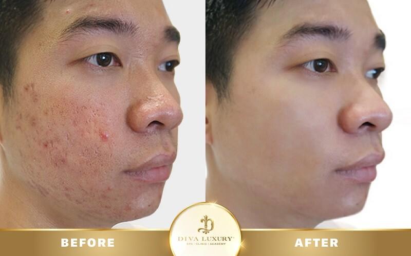 DIVA Spa Quảng Nam
