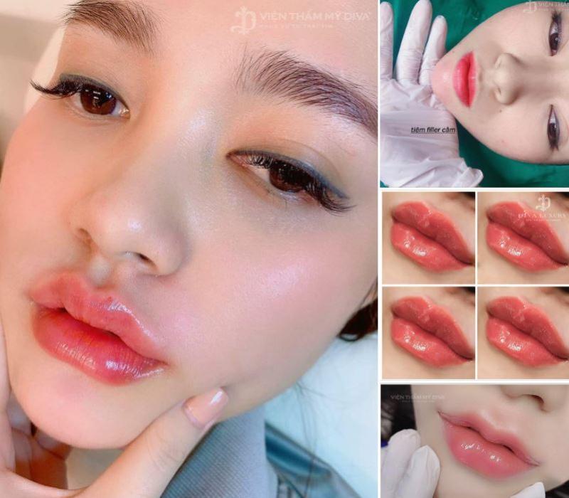 Viện thẩm mỹ Diva - Đà Nẵng