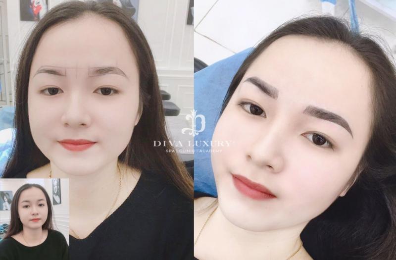 Viện Thẩm Mỹ DIVA - Sóc Trăng
