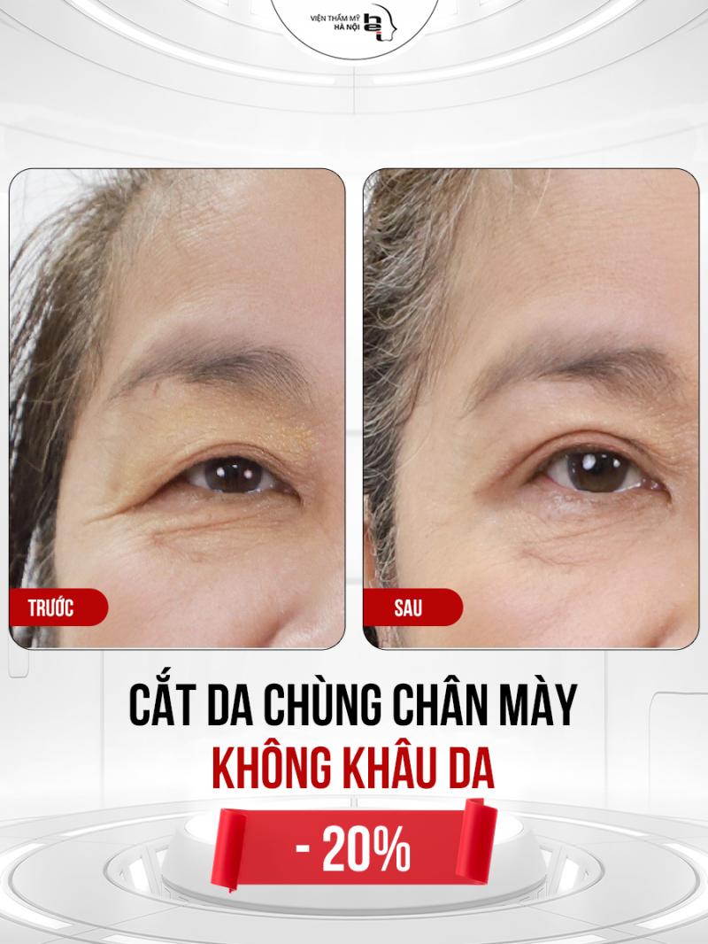 Viện Thẩm Mỹ Hà Nội
