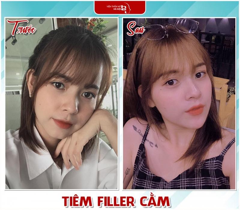 Viện Thẩm Mỹ Hà Nội