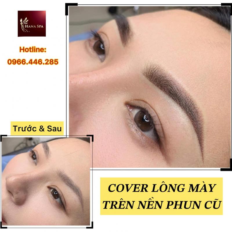 Viện Thẩm Mỹ Hana