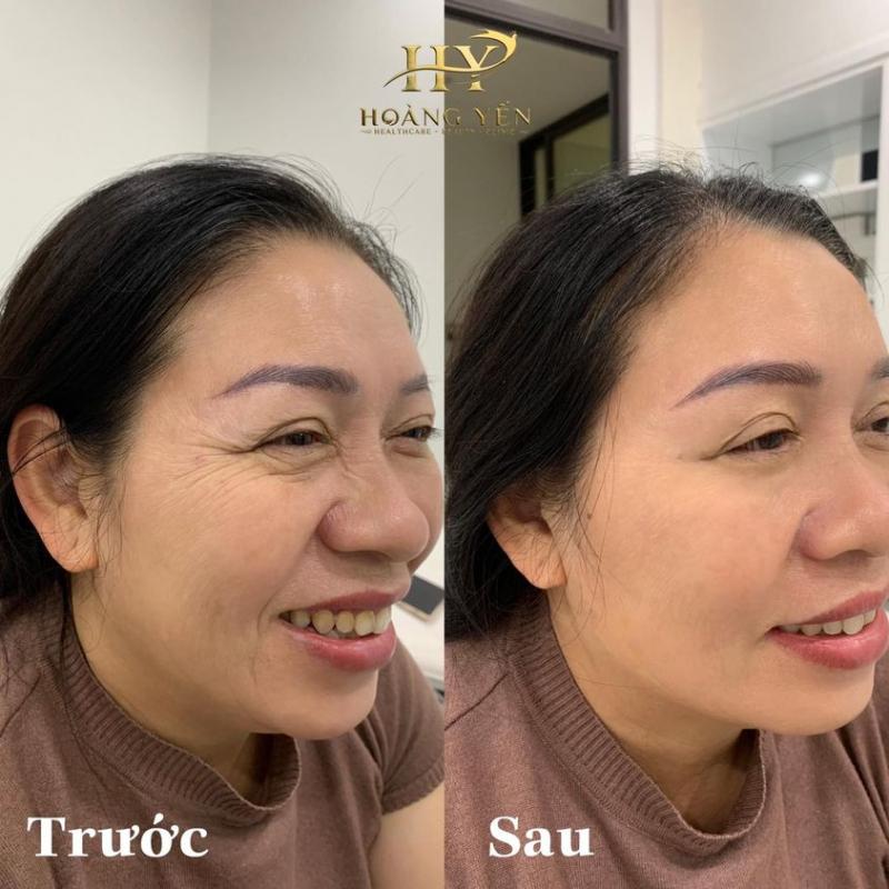 Viện Thẩm Mỹ Hoàng Yến
