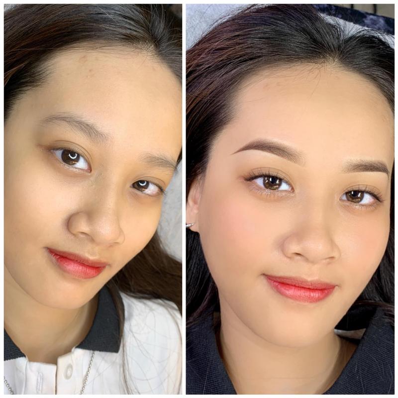 Viện Thẩm Mỹ Kjm 4