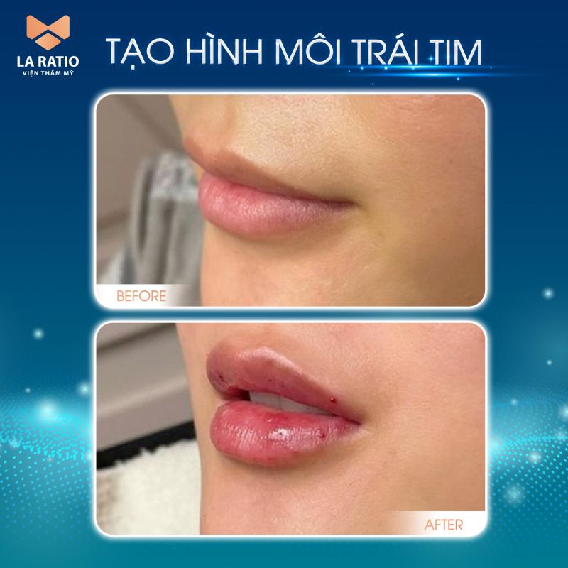 Viện Thẩm Mỹ La Ratio