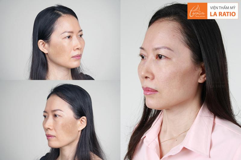 Viện Thẩm Mỹ La Ratio