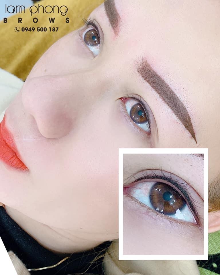 Viện thẩm mỹ - Lâm Phong Natural