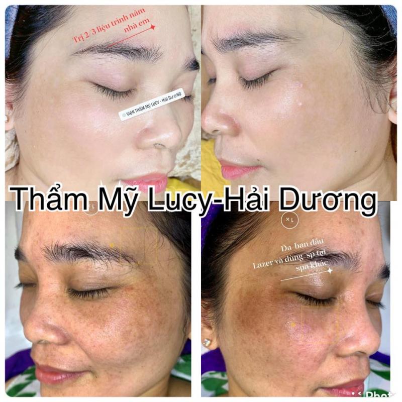 Viện Thẩm Mỹ Lucy