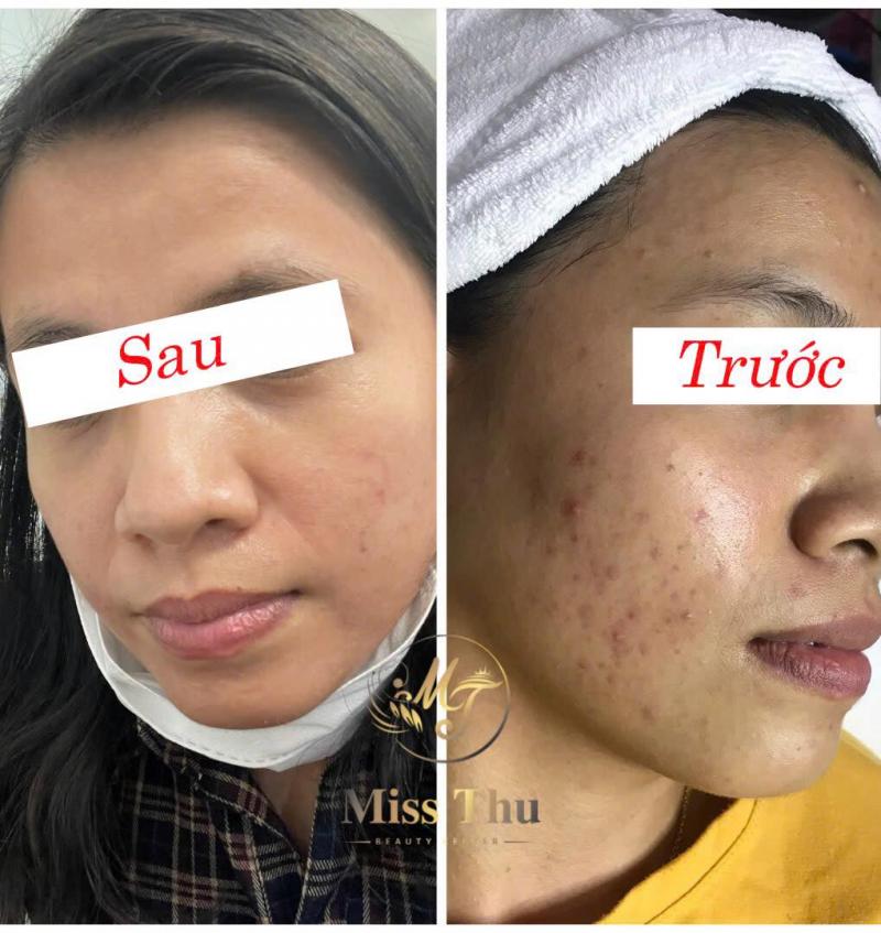 Viện Thẩm Mỹ Miss Thu