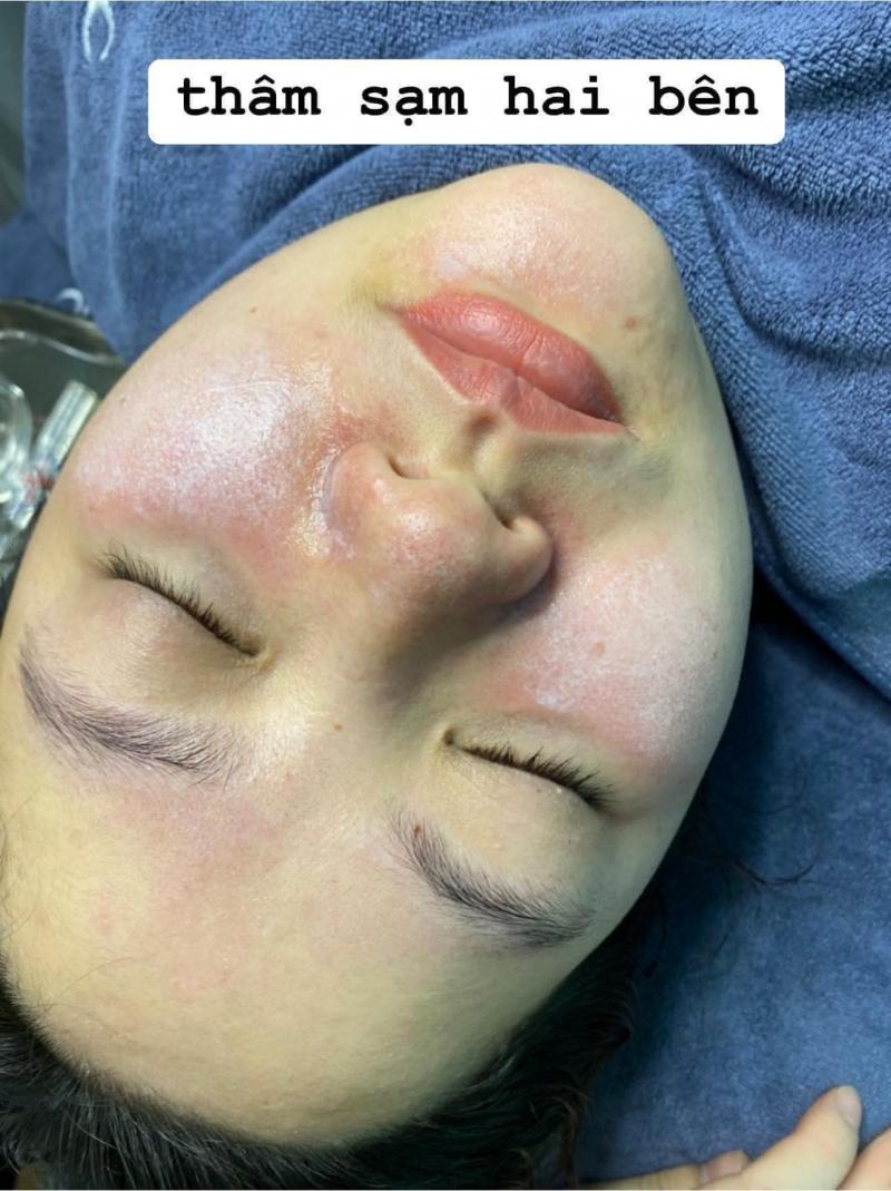 Viện Thẩm Mỹ Ngọc Anh