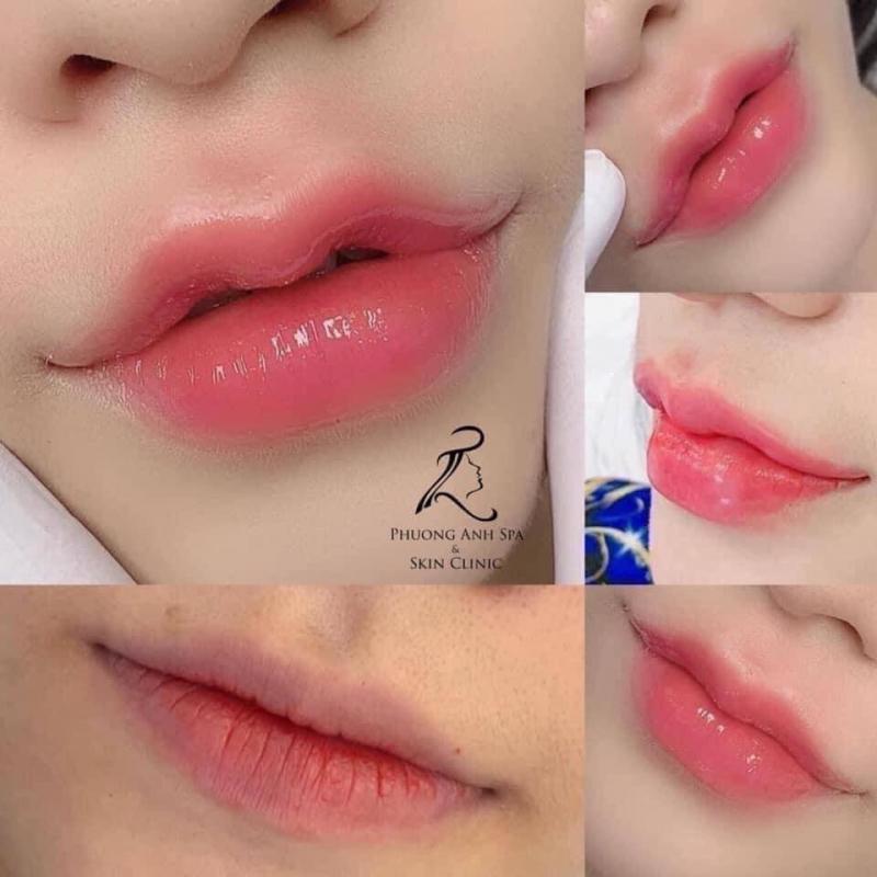 Viện Thẩm Mỹ Phương Anh