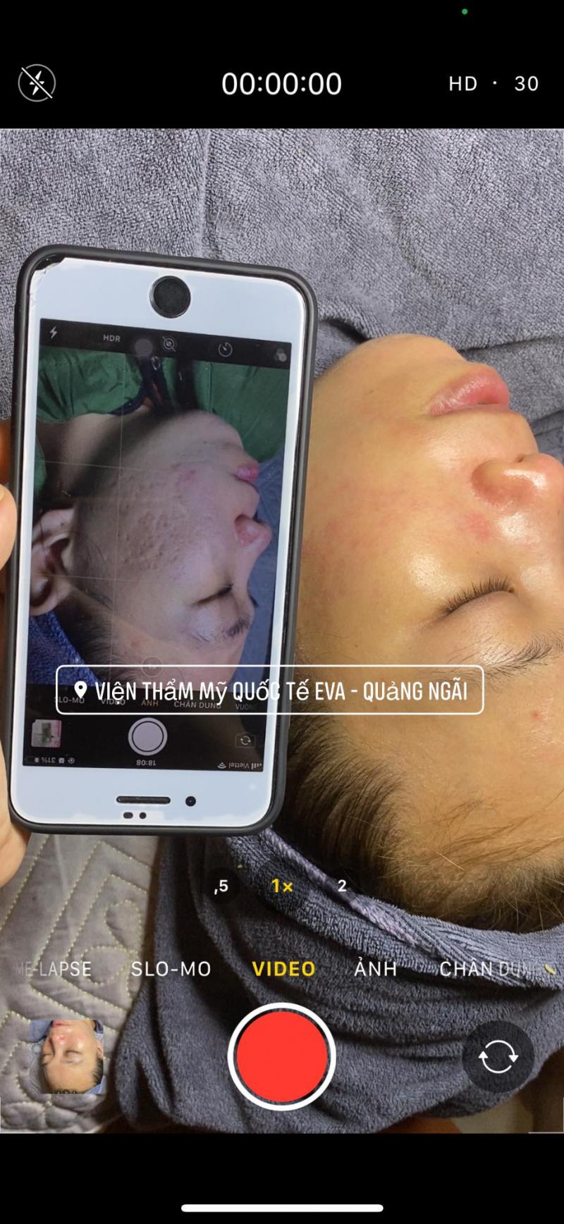 Viện Thẩm Mỹ Quốc Tế EVA