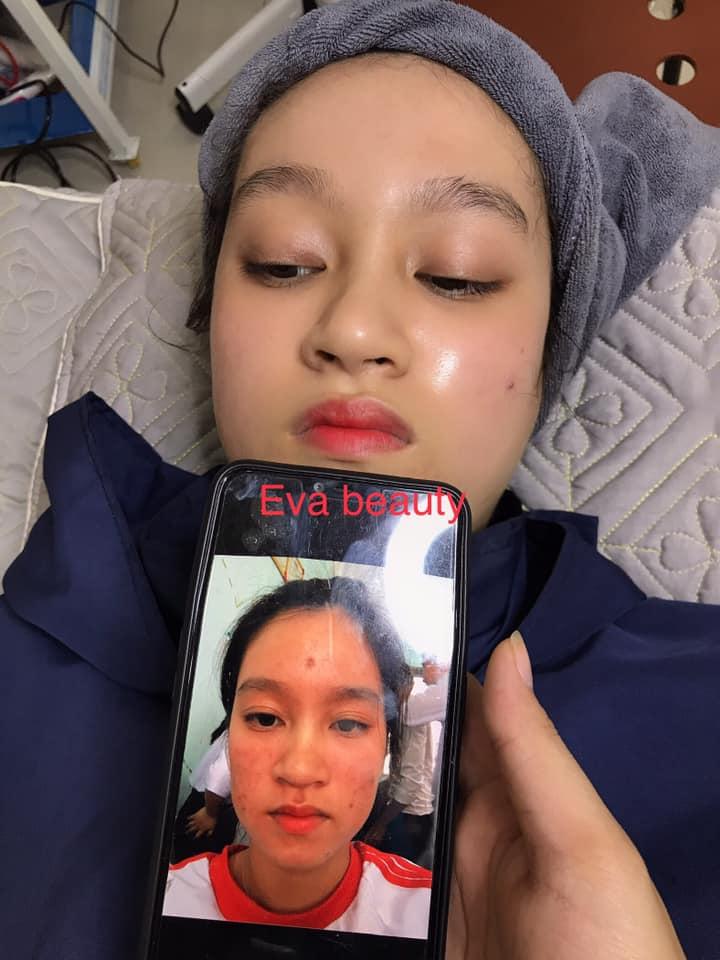 Viện Thẩm Mỹ Quốc Tế EVA