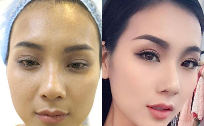 Viện Thẩm Mỹ Quốc Tế Gangnam - CN Hà Tĩnh