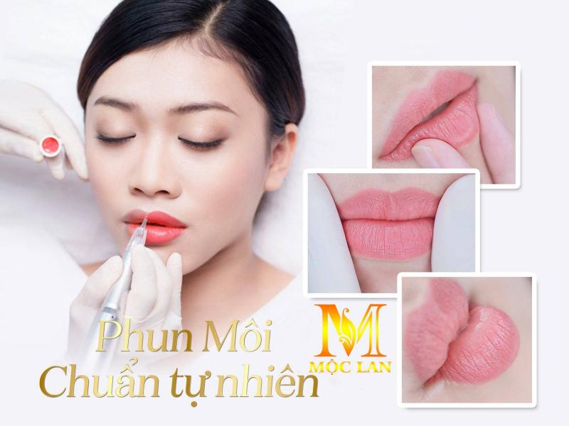Viện thẩm mỹ Quốc tế Mộc Lan