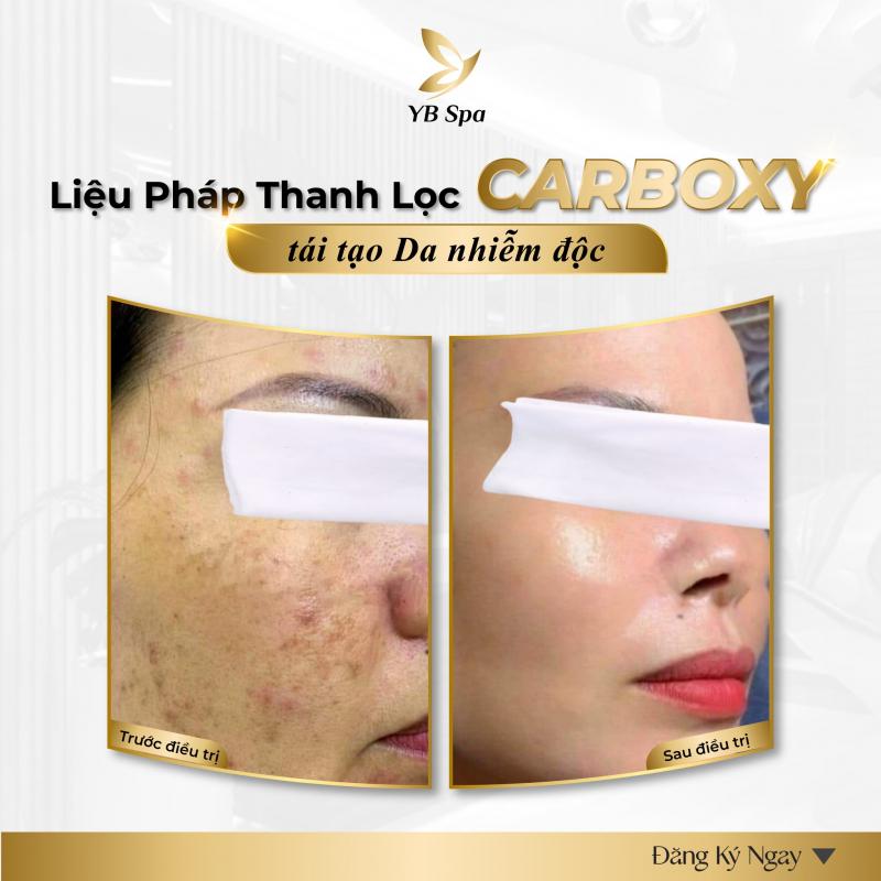 Viện Thẩm Mỹ Quốc Tế YB Spa