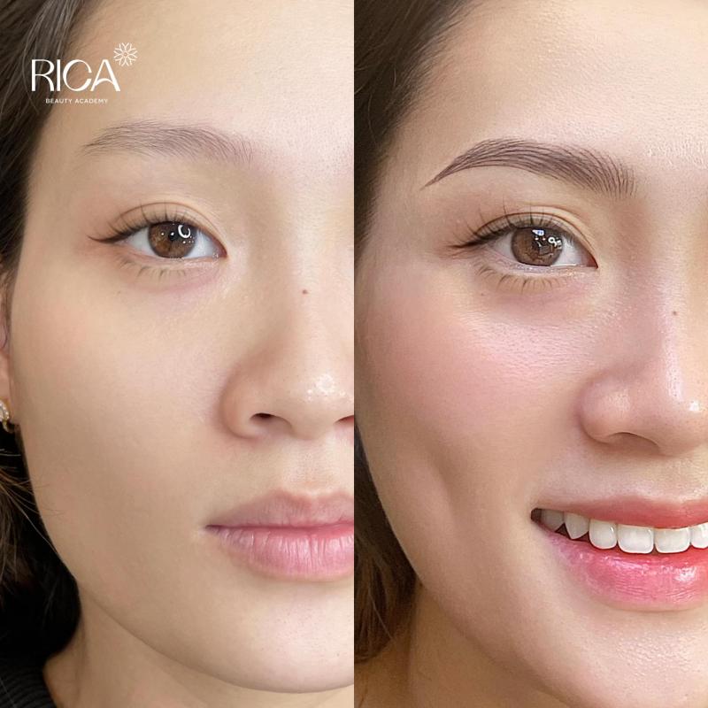 Viện Thẩm Mỹ RICA