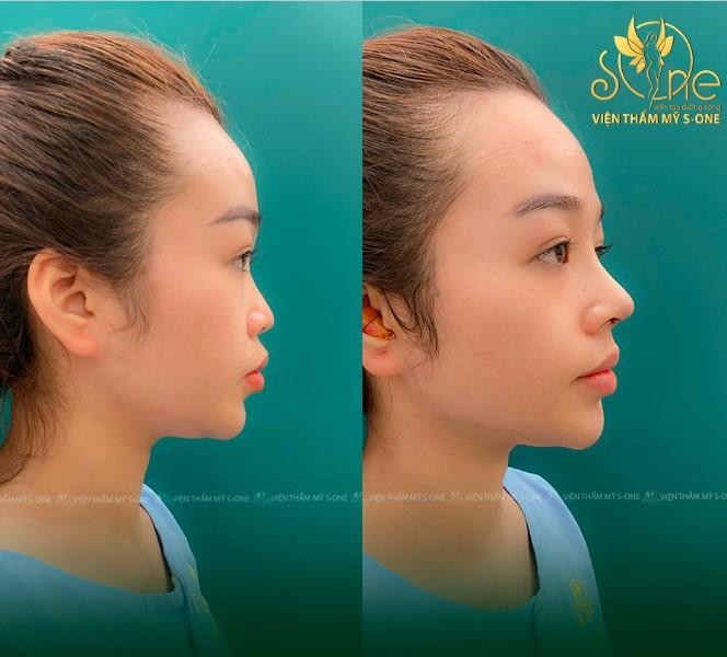 Viện thẩm mỹ S - ONE