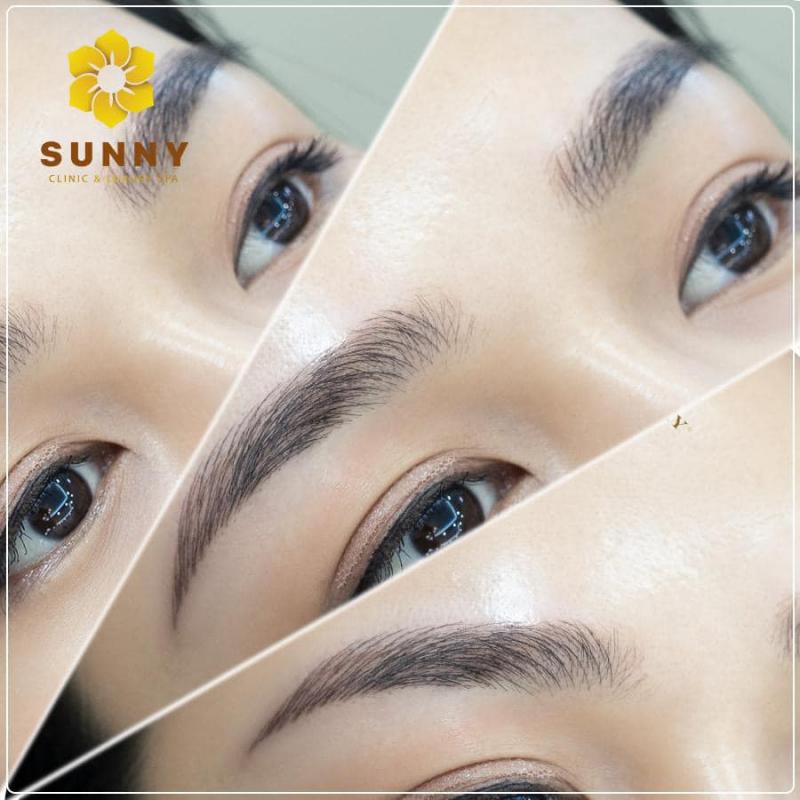 Viện Thẩm Mỹ Sunny