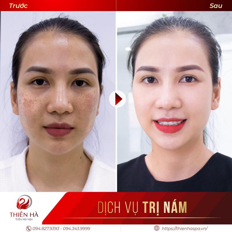 Viện thẩm mỹ Thiên Hà