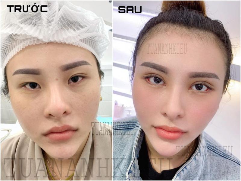 Chuyên gia Tuấn Anh Kiều