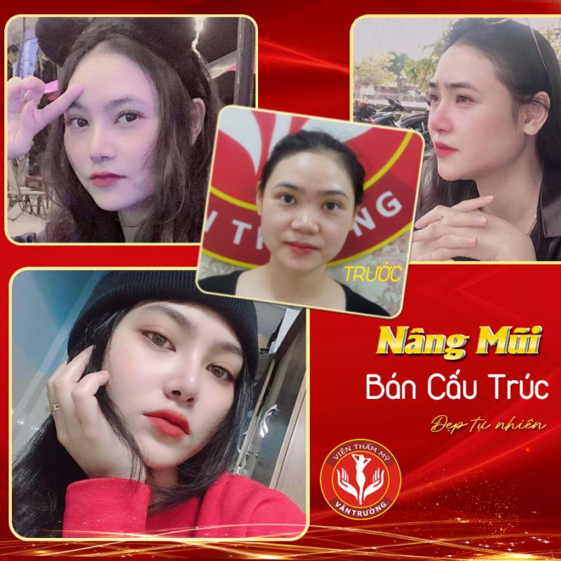 Viện Thẩm mỹ Văn Trường
