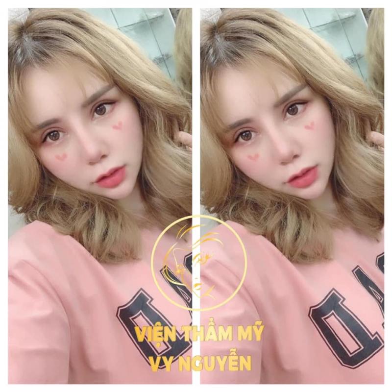 Viện Thẩm Mỹ Vy Nguyễn