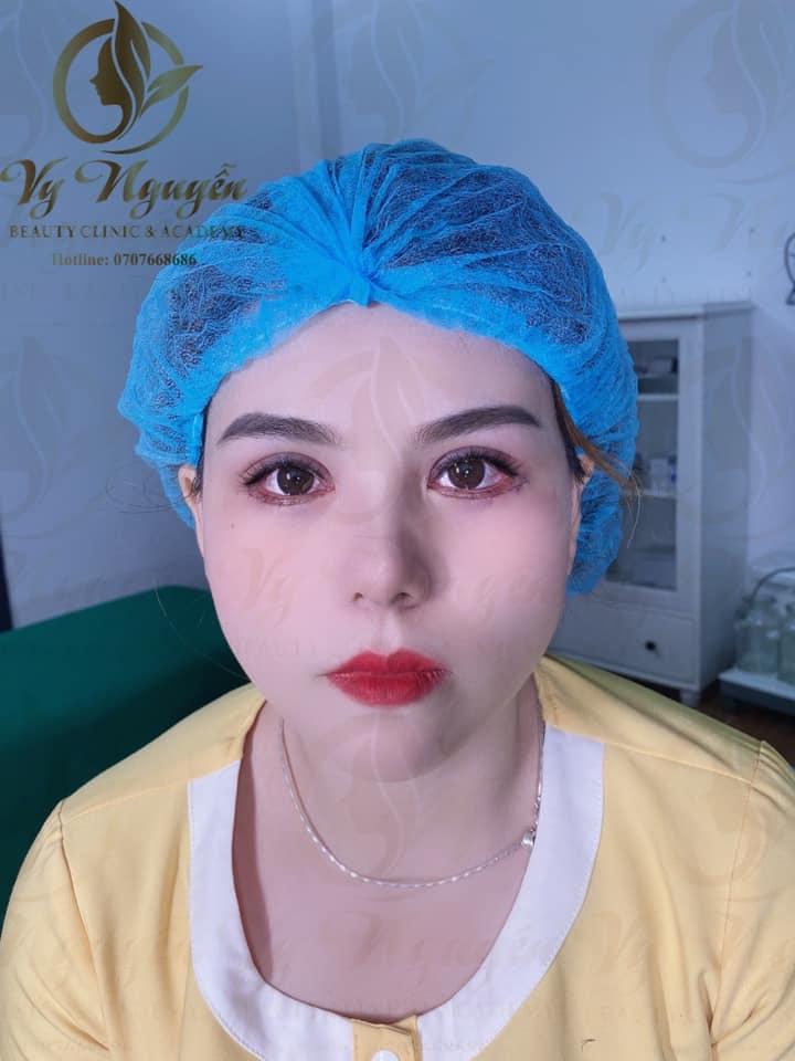 Viện Thẩm Mỹ Vy Nguyễn