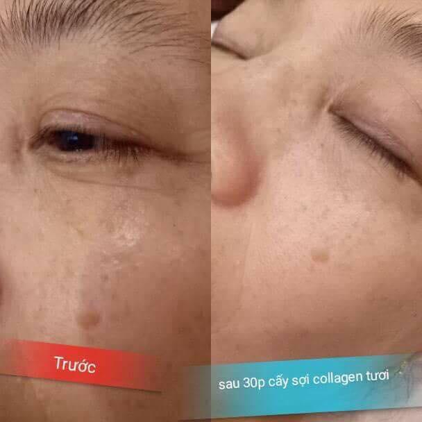 Oanh Spa