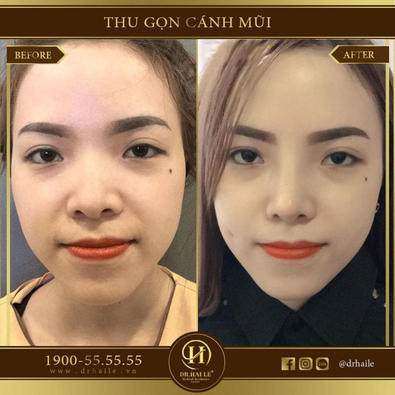 Viện Thẩm Mỹ Y Khoa Dr.Hải Lê