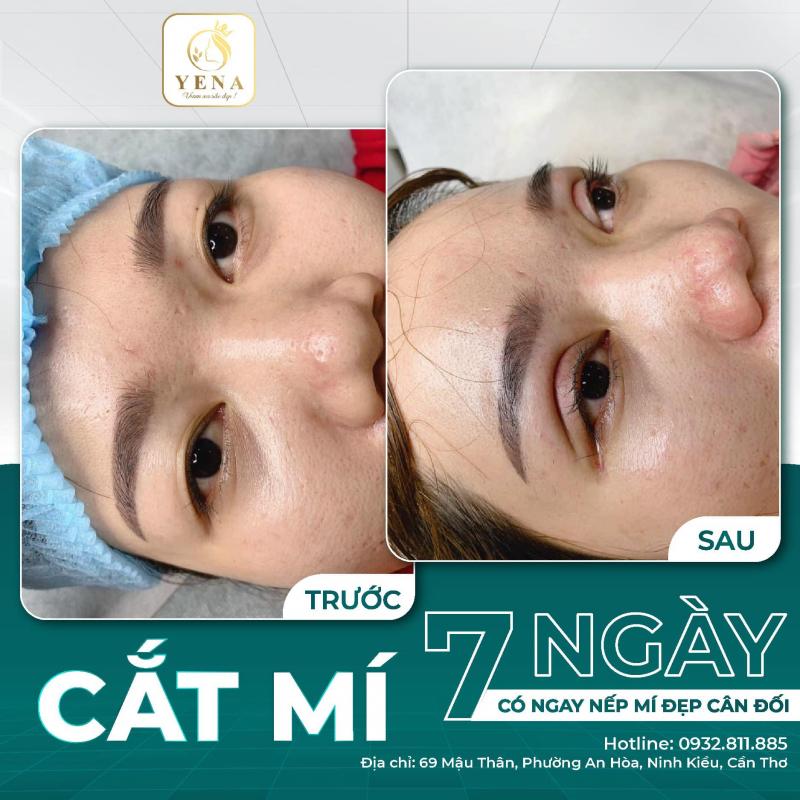 Thẩm Mỹ Viện Yena Cần Thơ