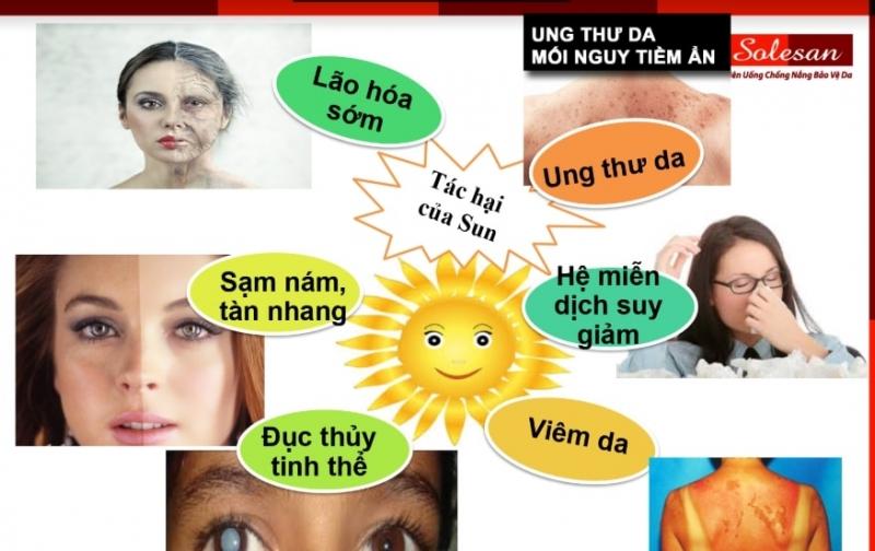 Viên uống chống nắng Solesan