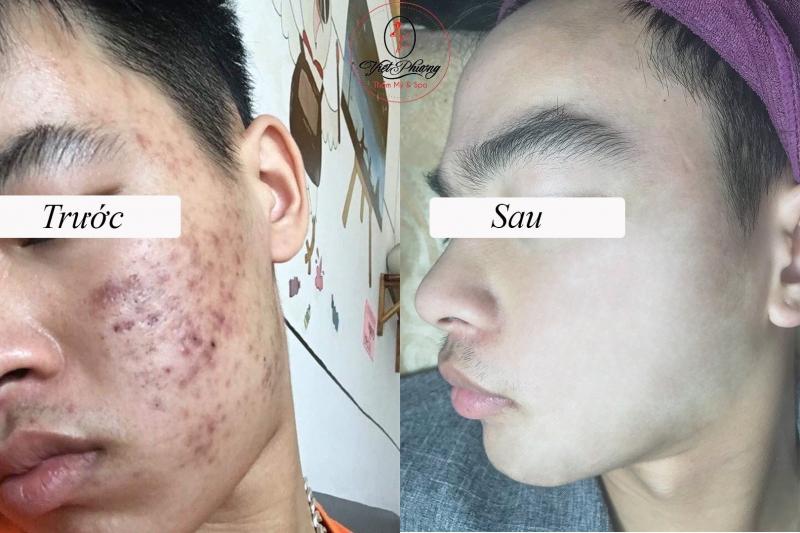 Việt Phượng Luxury Beauty Spa & Clinic