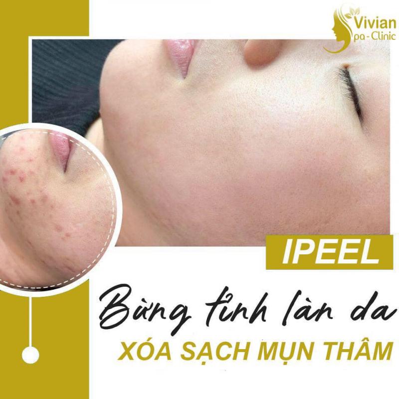 Vivian Nha Trang